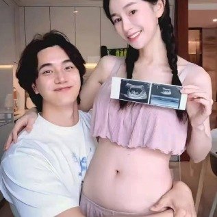 张檬自曝孕35周臀位绕颈作为母亲的她，付出了太多太多，看到张檬的坚强，心里满是疼