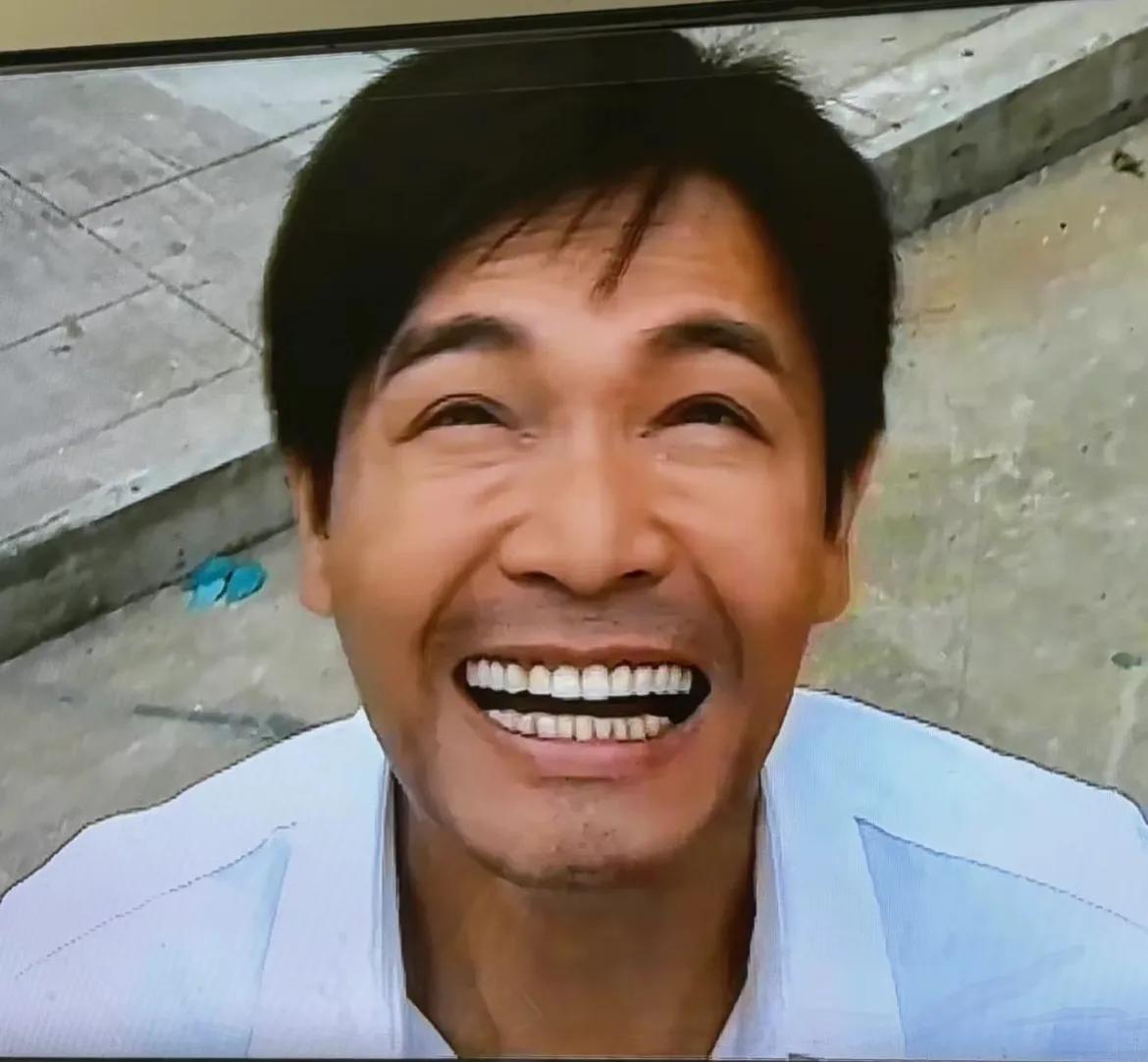 郭晋安真的好多牙牙牙牙牙牙！
看得我密集恐惧症犯了！