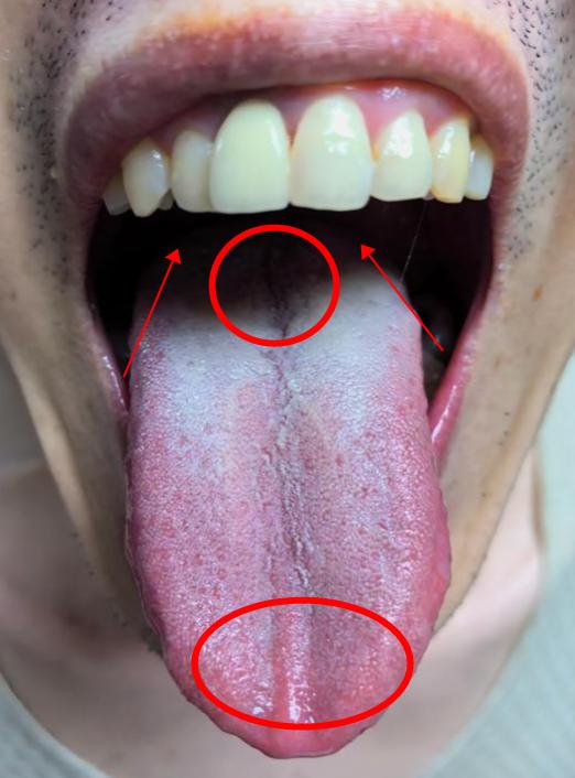 上热下寒，这种舌象在当代中青年身上，实在太多了！
李主任提醒一定要做到这2点，一