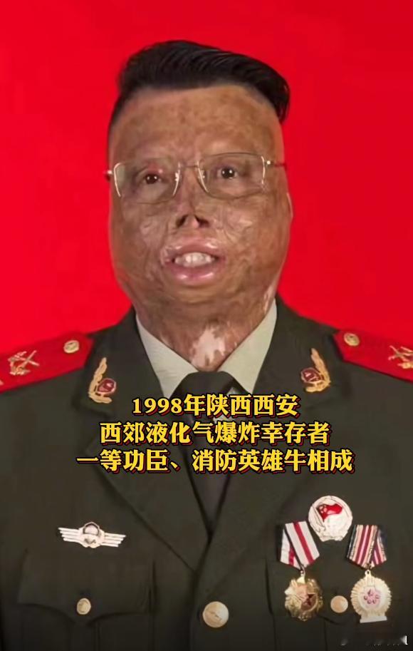 请您停留一秒钟为消防英雄牛相成献上一朵鲜花！舍身救人烧伤面积 达97%，立一等功