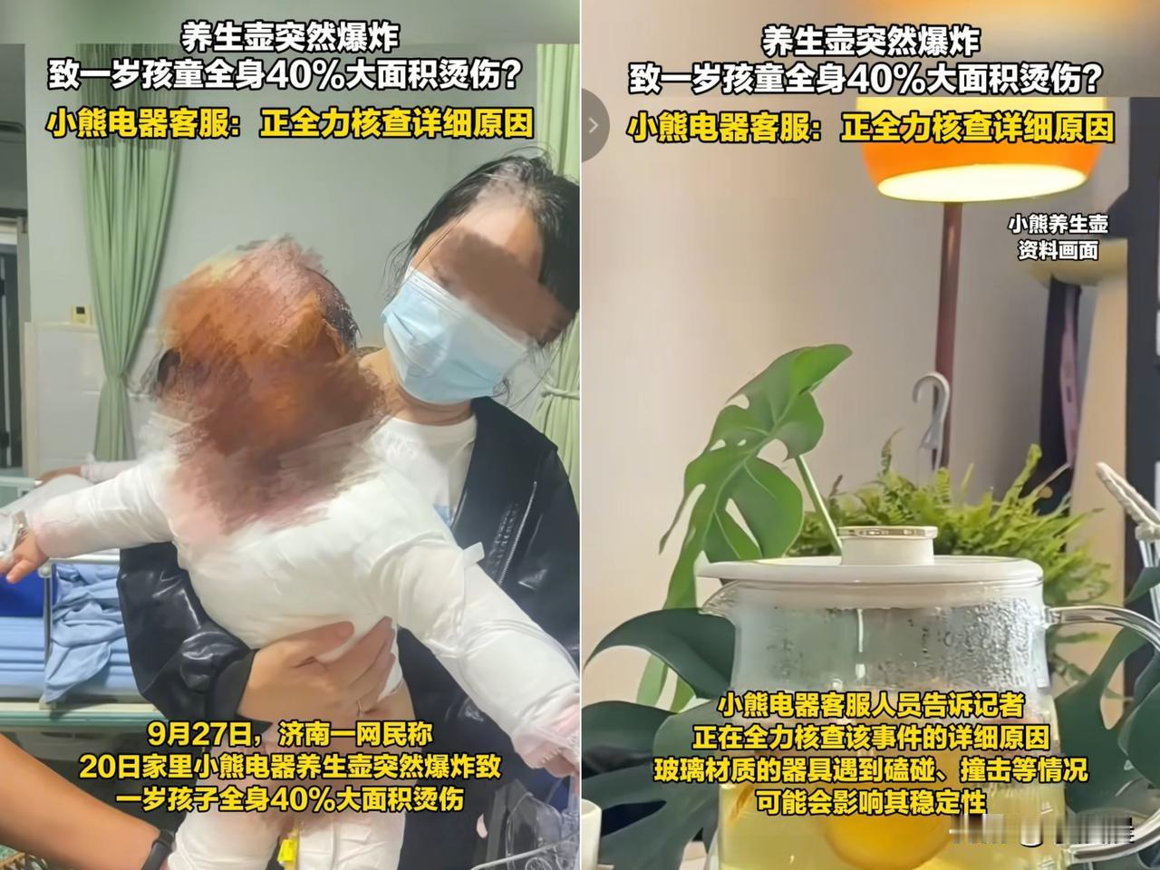 济南这事儿看完真让人揪心！

一岁娃被养生壶炸得全身40%烫伤，

得反复植皮，