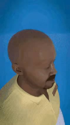 脑溢血的动画演示图: 很清晰地可以看出得这病的人是怎么得的，一旦发病，就很麻烦，