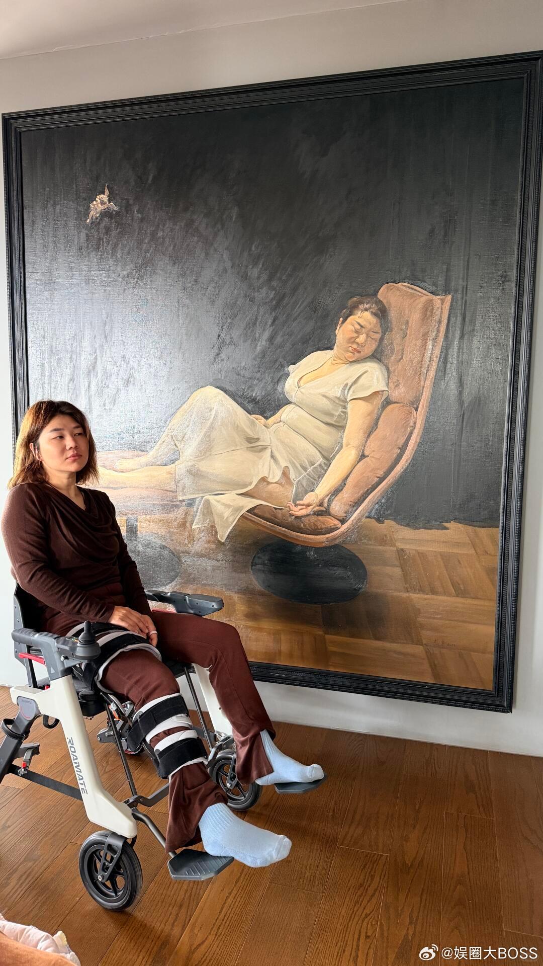 杨天真坐轮椅出席年会杨天真因滑雪摔伤要拄拐6周 膝盖多处撕裂受伤，依然坐轮椅坚持