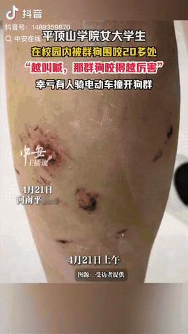 河南平顶山学院，一女大学生在校园里正常走路，没想到一只黑狗突然窜出来咬她，然后又