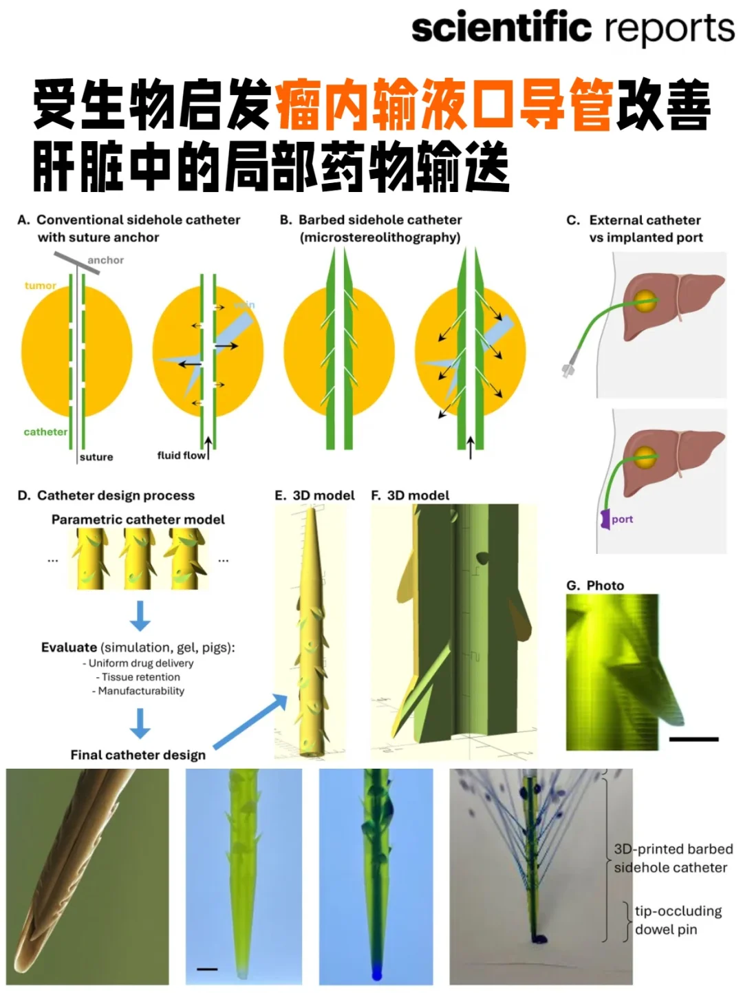 仿蜜蜂尾针🐝 瘤内输液口导管用于药物输送