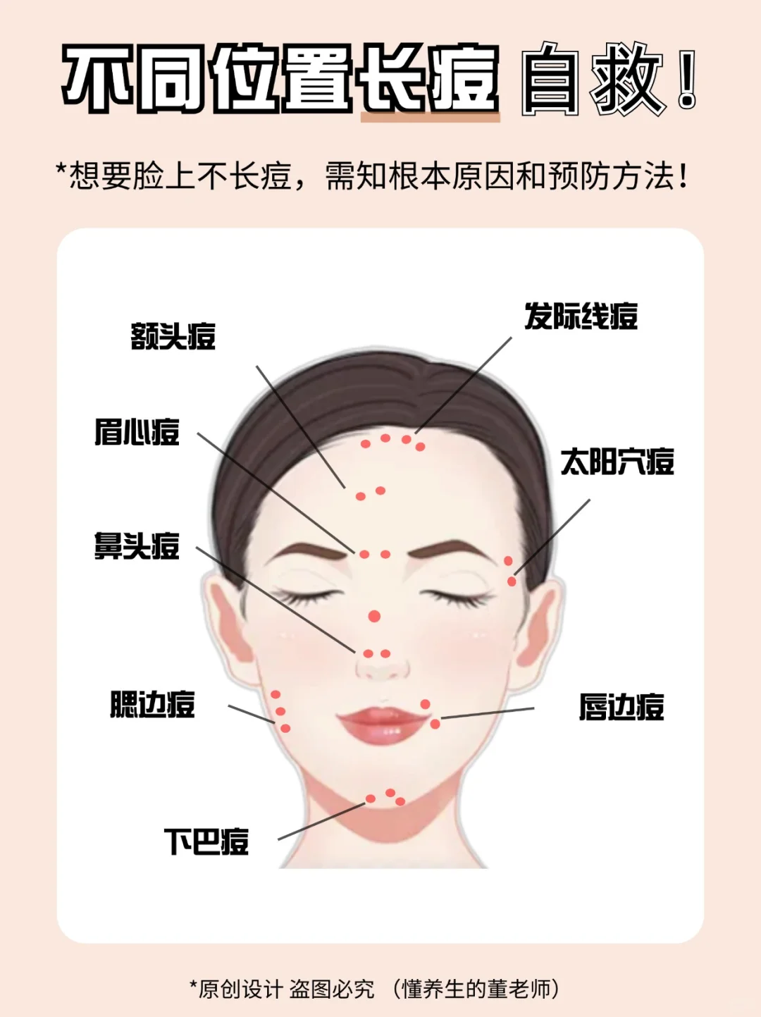 脸上不同位置长痘原因及对策！✅调理收藏