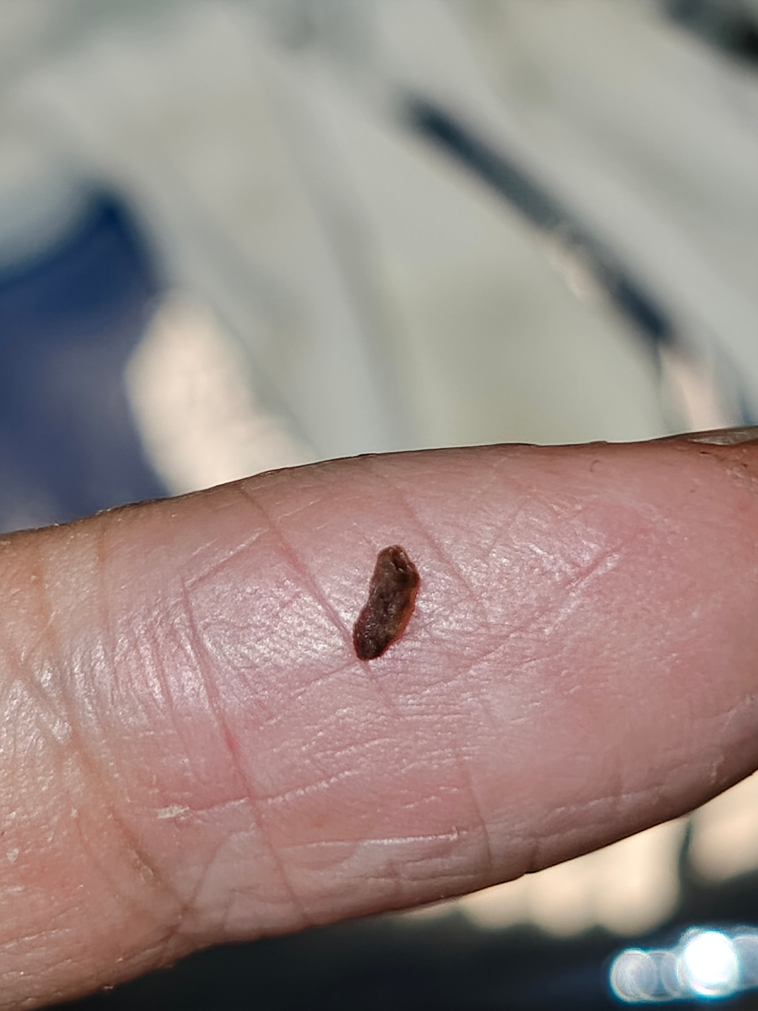 刷牙莫名其妙掉了一块牙结石。之后刷牙就有点出血。自己检查了一下，发现有点充血点，