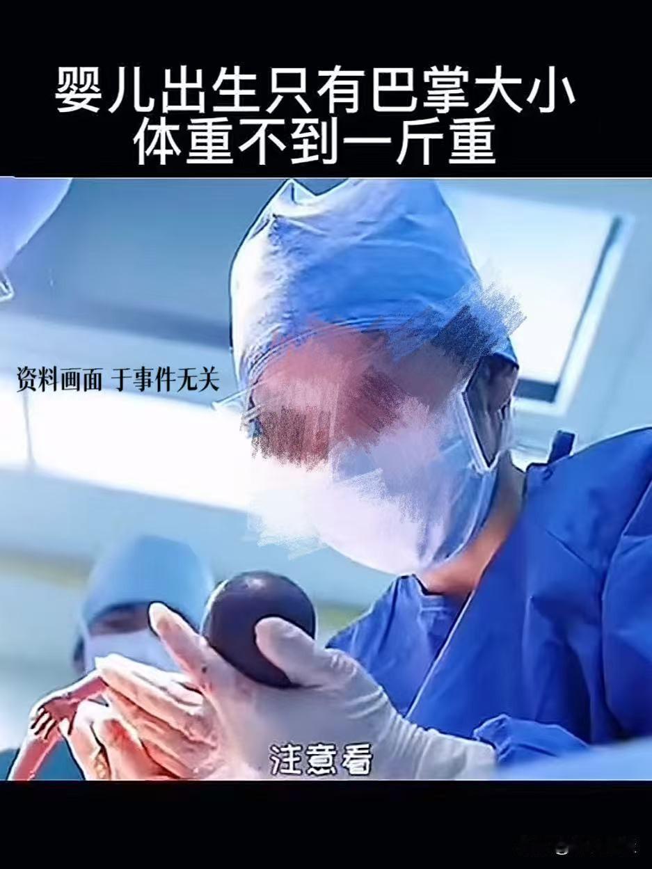 “是爱还是自私？”女子为圆丈夫的临终心愿，提前5个月刨腹产，让一个不足1斤重的早