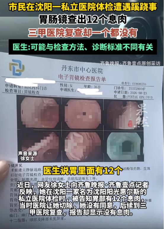 丧尽天良！8 月 22 日辽宁沈阳，女子陪丈夫参加单位体检，顺手做了个胃肠镜。麻