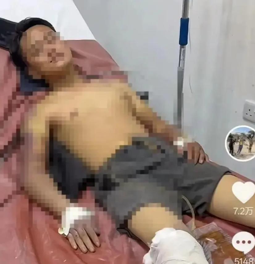 在非绑架殴打同胞的网红非洲洋洋获刑 4 年，受害人直言等他回国还要继续起诉。这场