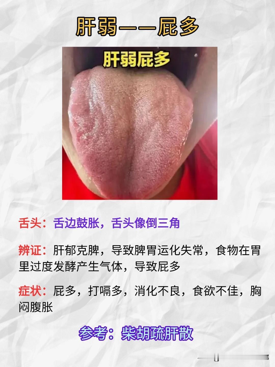 肝弱——屁多，肾弱——尿多，肺弱——汗多，脾弱——痰多，用对4个中成药，全解决