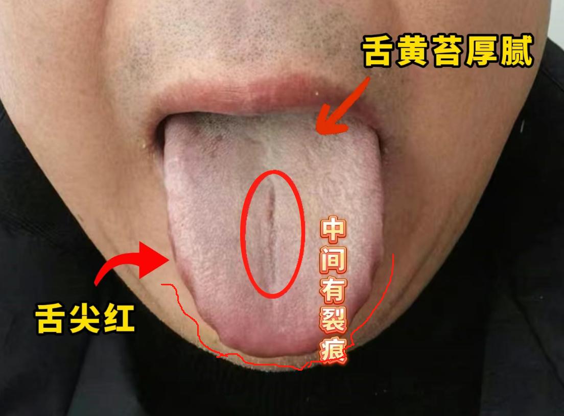 既心疼，又好笑，你说看个病遮遮掩掩的干啥.....[捂脸]
不就是时间短嘛！问了