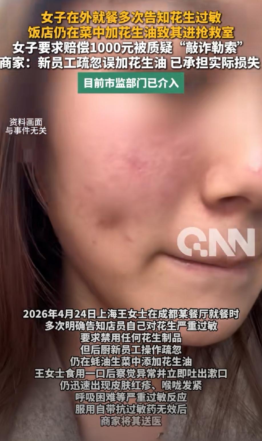 四川成都，女子对花生严重过敏，就餐时她特意提醒店员，还多次告知这一情况，不成想，