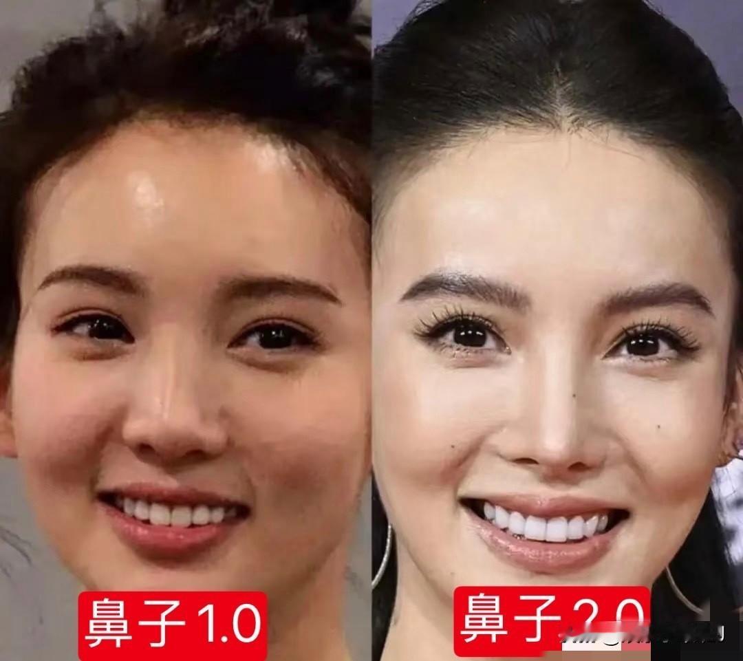 医美金晨以前不长这样！不要过度医美啊？哎！ ​​​这已经不是医美了，整容加上太瘦