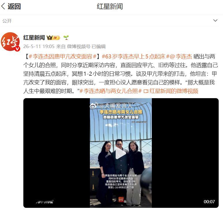 李连杰因患甲亢改变面容   感觉李先生最近在网上很活跃63岁李连杰早上5点起床，