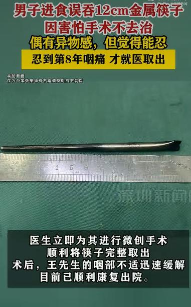 一位46岁的王先生因咽部突发剧痛和异物感前往医院就诊，没想到检查结果让在场的医生