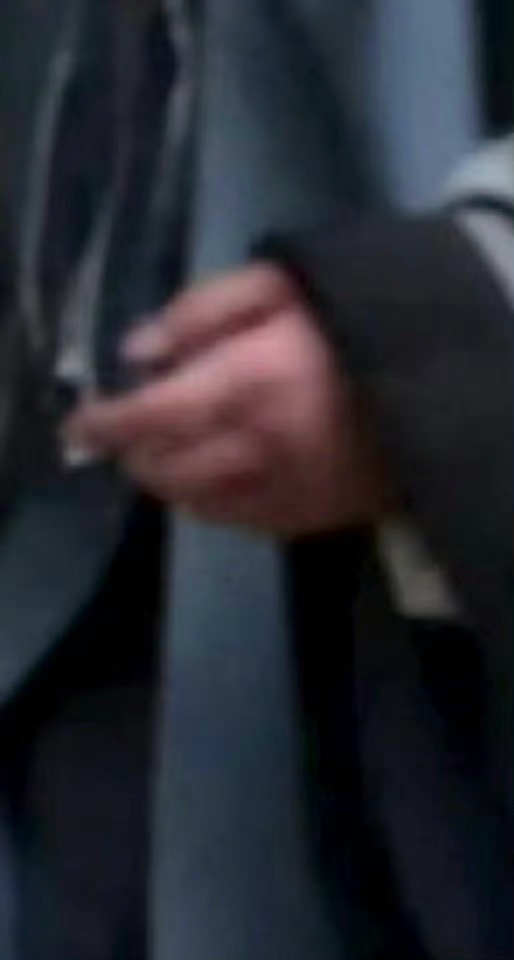 杨洋的手怎么这么肿？杨洋的手好肿杨洋不让江山造型路透