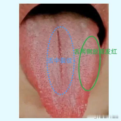 脾虚生百病，调理顺序错了，再吃十年健脾药也无用！

今天我就来以一则患者病历来给