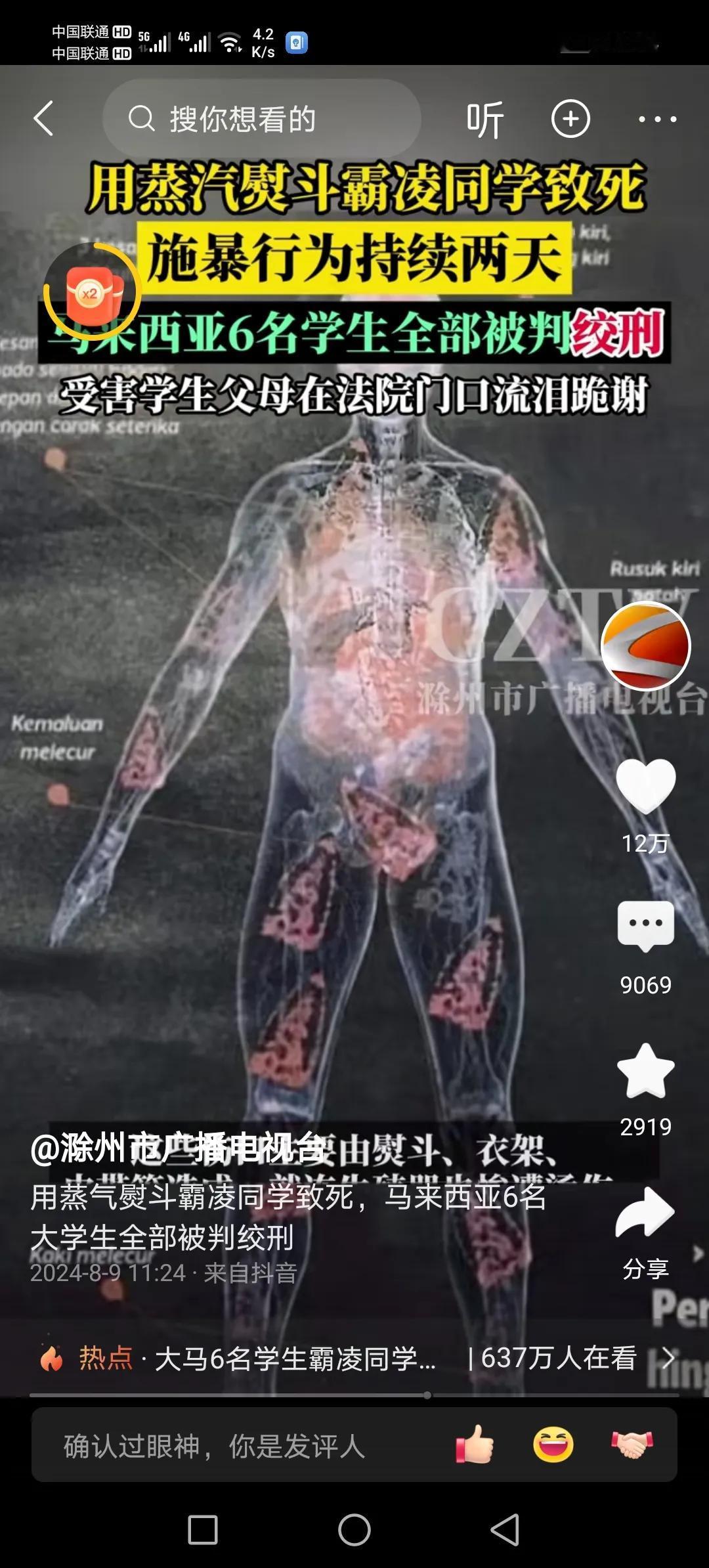 #寻找热爱表达的你#马来西亚霸凌同学致死案宣判，六名大学生凶手均被被判绞刑！！！