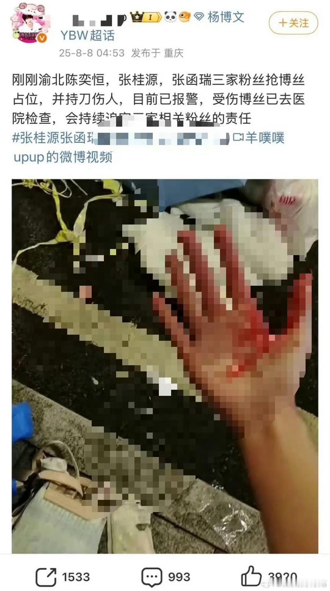 我去好可怕，追星还带着🔪啊 ​​​