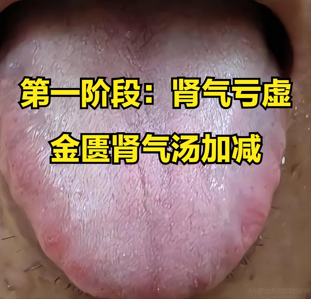 年轻时越放纵，如今越疲惫！肾虚4个阶段，看看你已到哪一步？

第一阶段：肾气亏虚