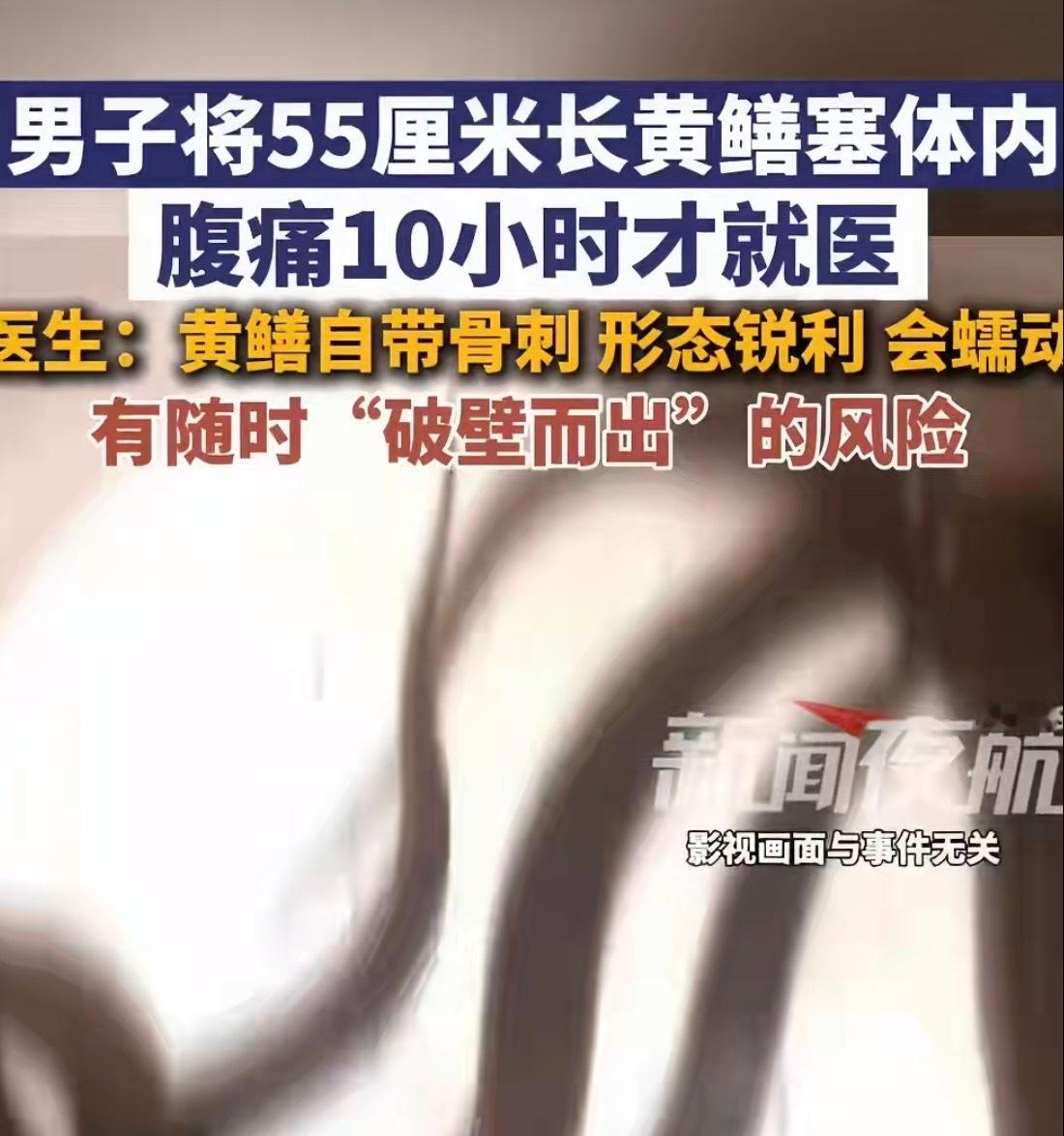 体内塞黄鳝[泪奔]..不过以前真的有个互联网事件闹得沸沸扬扬，也是黄鳝。 ​​​