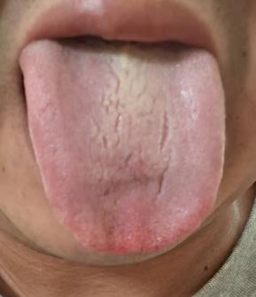 肾精不足兼有肝郁湿热，机体失调标本兼顾调理思路







最近收到一位年轻粉