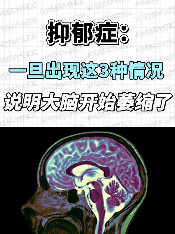 抑郁症：一旦出现这3种情况，说明大脑开始萎缩了！ . 1、持续的疲惫感...