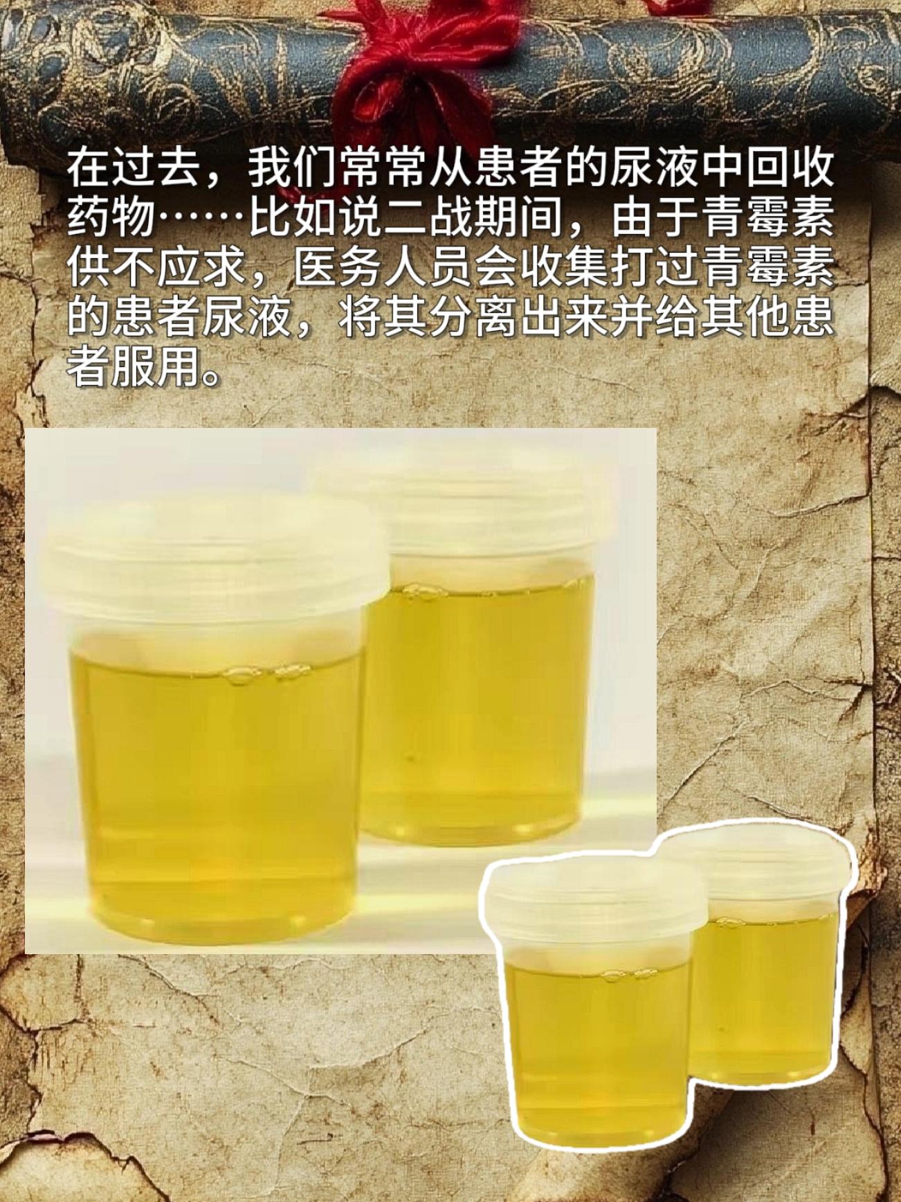 在过去，我们常常从患者的尿液中回收药物……比如说二战期间，由于青霉素供...