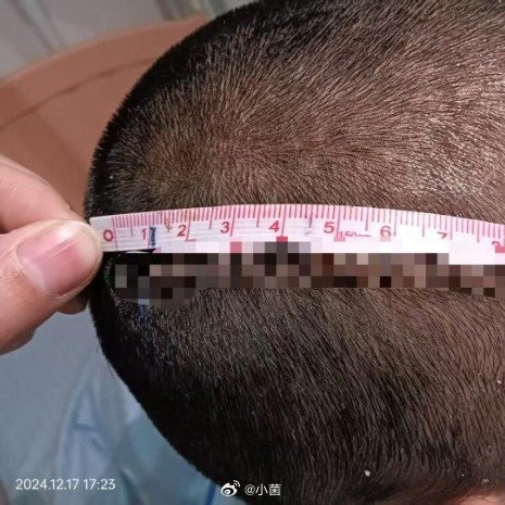 误会孙女被打爷爷重伤其同学获刑真是悲剧。因误会就暴力报复，无期徒刑不冤。但这背后