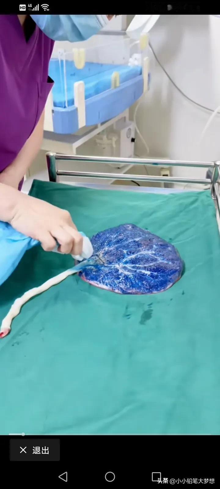 天呐，现在胎盘都能玩出花来了！现在私立医院还搞这样的花里胡哨的事情，妈妈生了宝宝