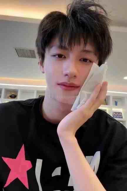 朱志鑫张极拔智齿后 