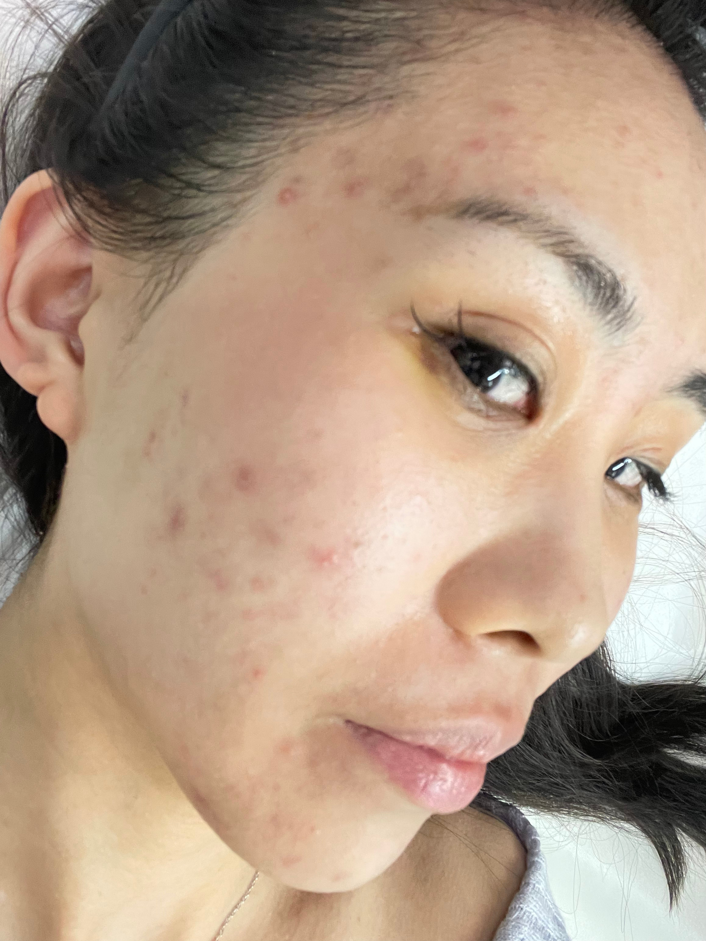 我自己是很讨厌有些人乱造谣的造谣我在变美这件事上没拿到结果我是一万个不同意的 