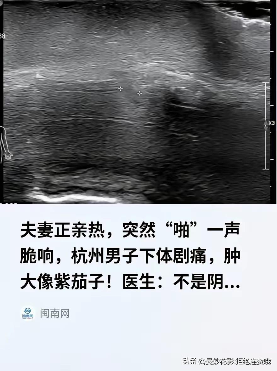 “光听着就疼！”浙江杭州，一49岁男子和妻子同房亲热时，动作猛了些，突然“啪”一