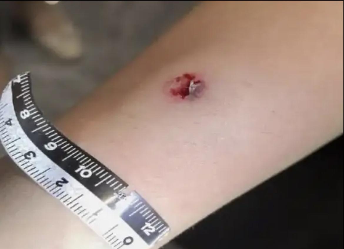杭州司机弹弓射伤4名路人案宣判，网友：这太狠了不能姑息！

2023年5月下旬，