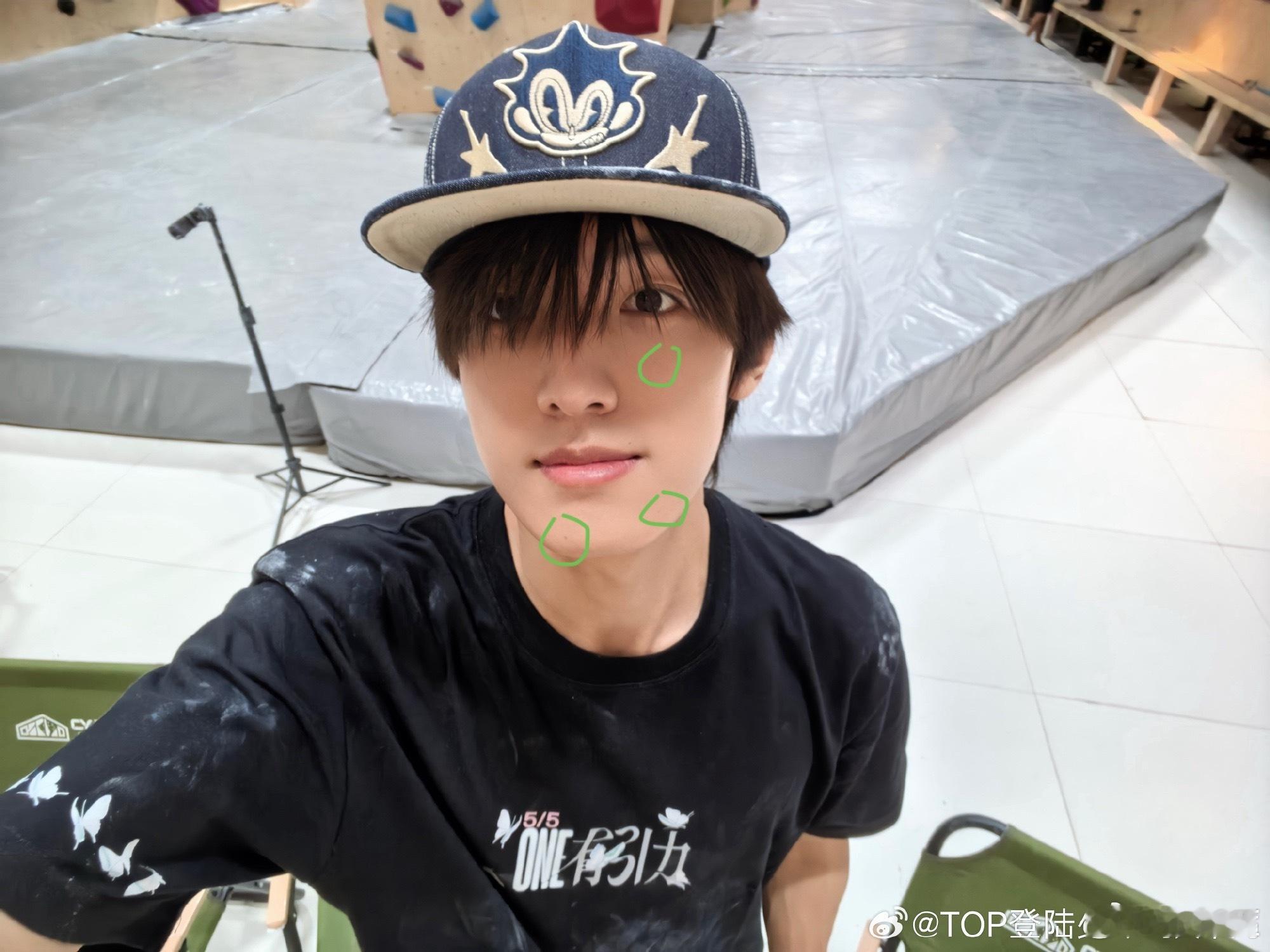 这三颗什么时候冒出来的 ​​​