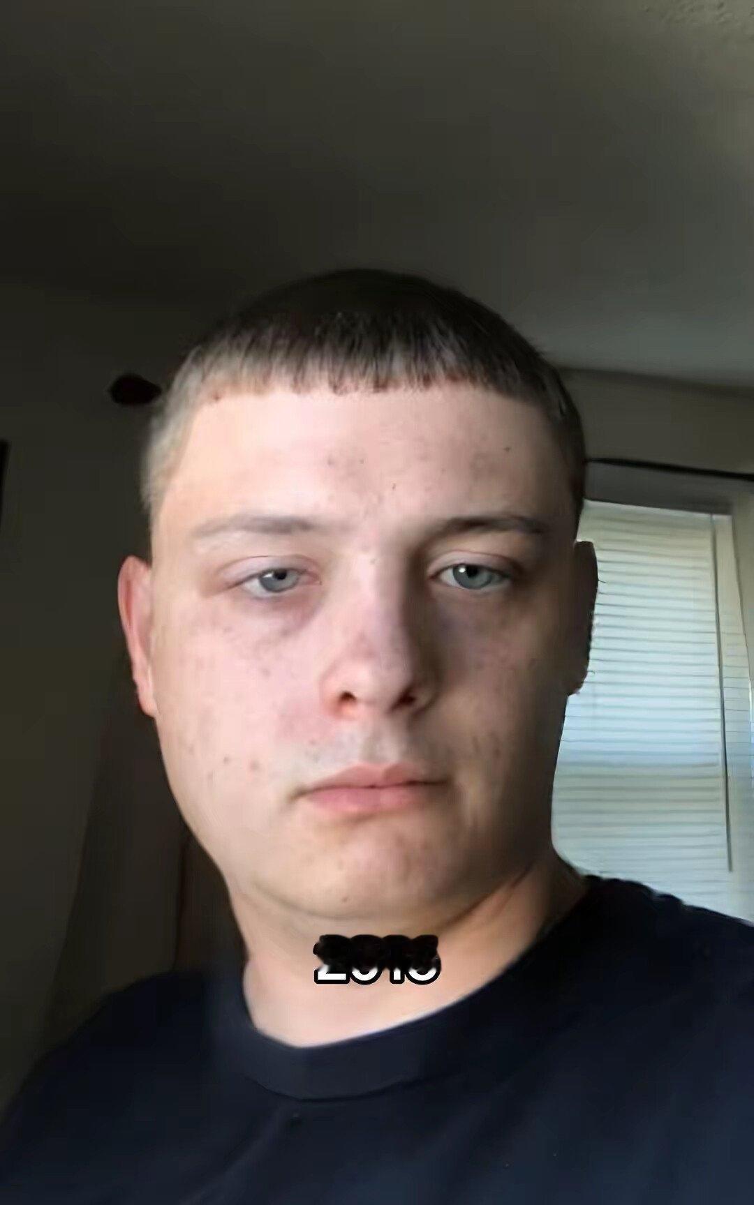 一个从2016年起完全将糖和面包从生活中排除的男人，通过健康饮食发现自己每年都显