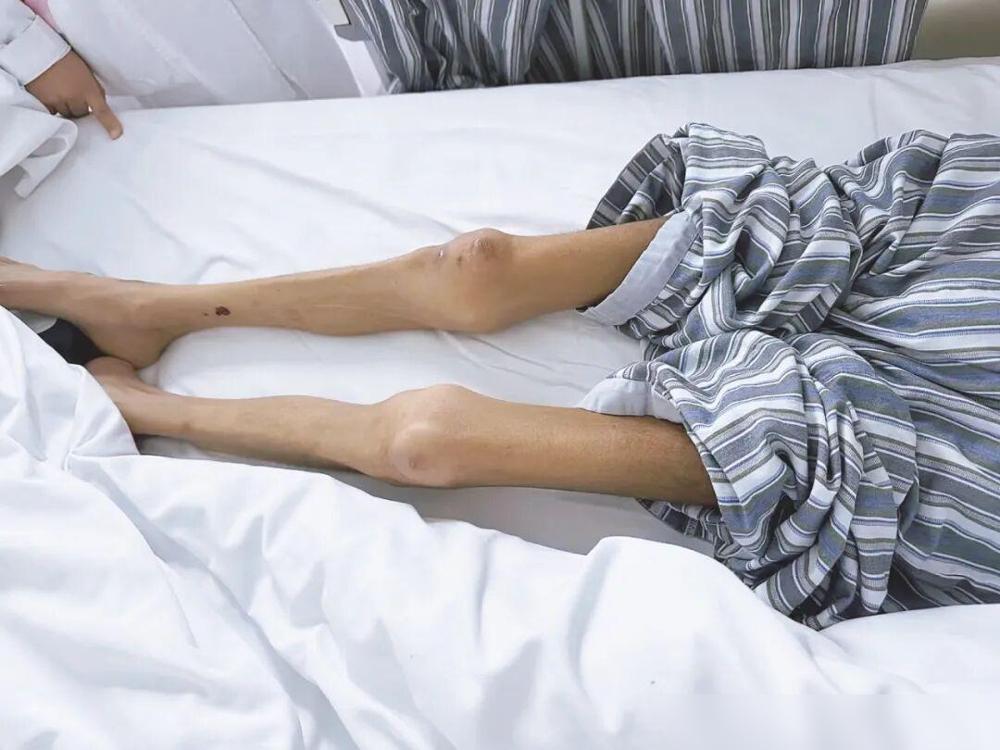 弟弟38岁，得了骨癌，6个月就死了！

说真的这事儿我现在想起来都堵得慌，最可惜