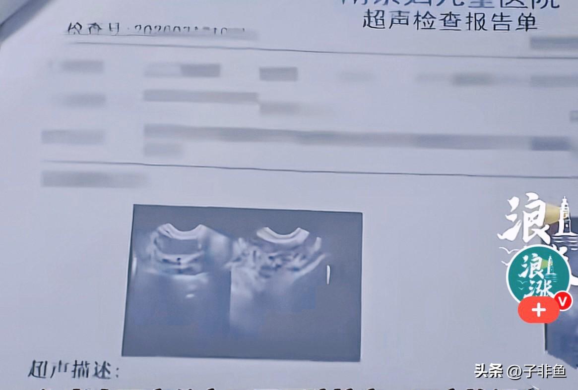 山东李女士近期只是轻微的妇科身体
不适，本来是很小的问题，结果刷到南京某医院的医
