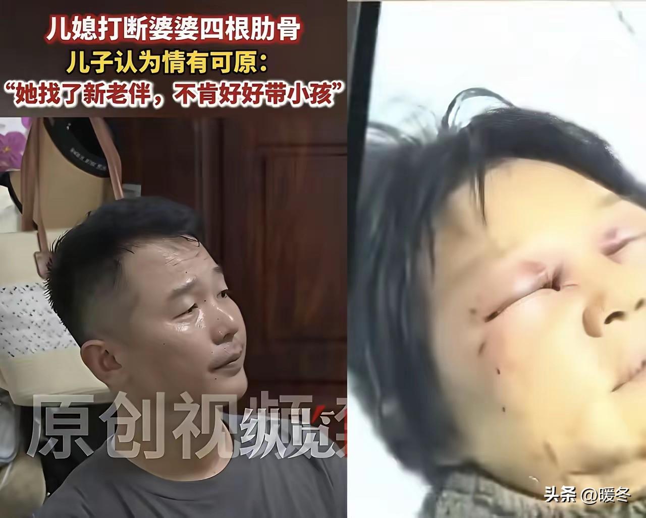 四根肋骨被打断！嘉兴最狠的不是施暴儿媳，是冷眼旁观的亲儿子
 
就因为一句不想再