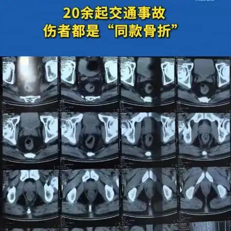 男子为赚几千块，3个月硬熬20次CT，把自己当骗保耗材

你敢信？有人把自己的身