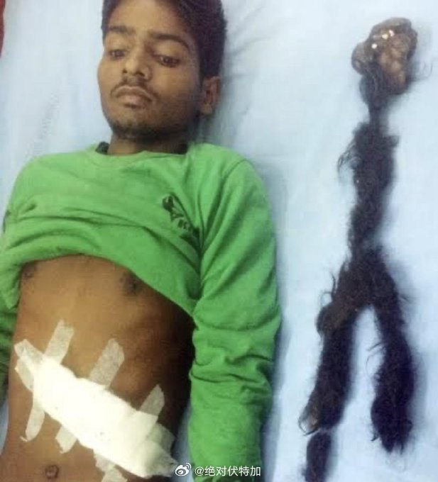 印度 Uttar Pradesh 的18岁 Narendra Kumar，以及在