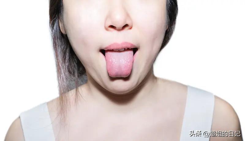 一是昨天没刷牙
二是昨天晚上吃什么东西了
三身体出现了问题
四应该是上火了
五积