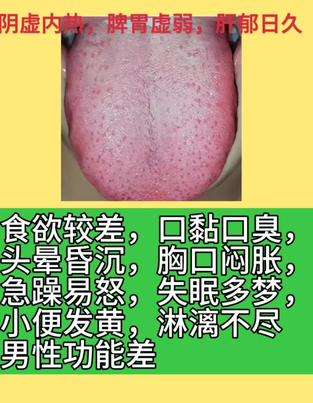 3 种复杂舌象辨证：肝脾肾失调，一辨就懂