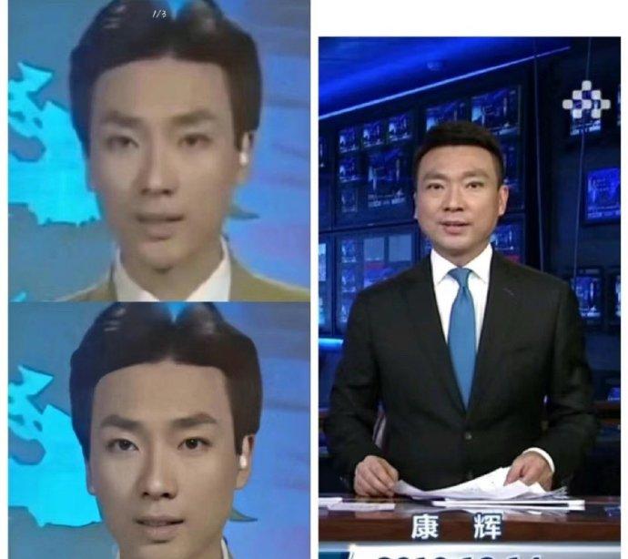 中年发腮其实不是坏事
下巴宽的人通常包容力也越强
包容力强的人下巴也会变宽或变厚