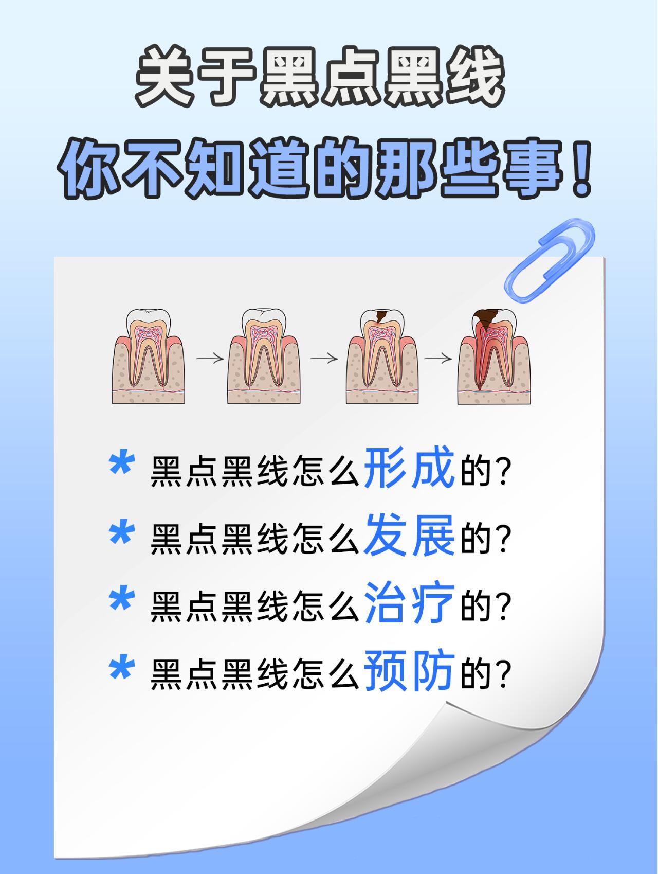 每天刷牙，怎么还是长黑点黑线？：“牙医拿金属钩子勾一勾咬合面发黑的地方，钩子进得