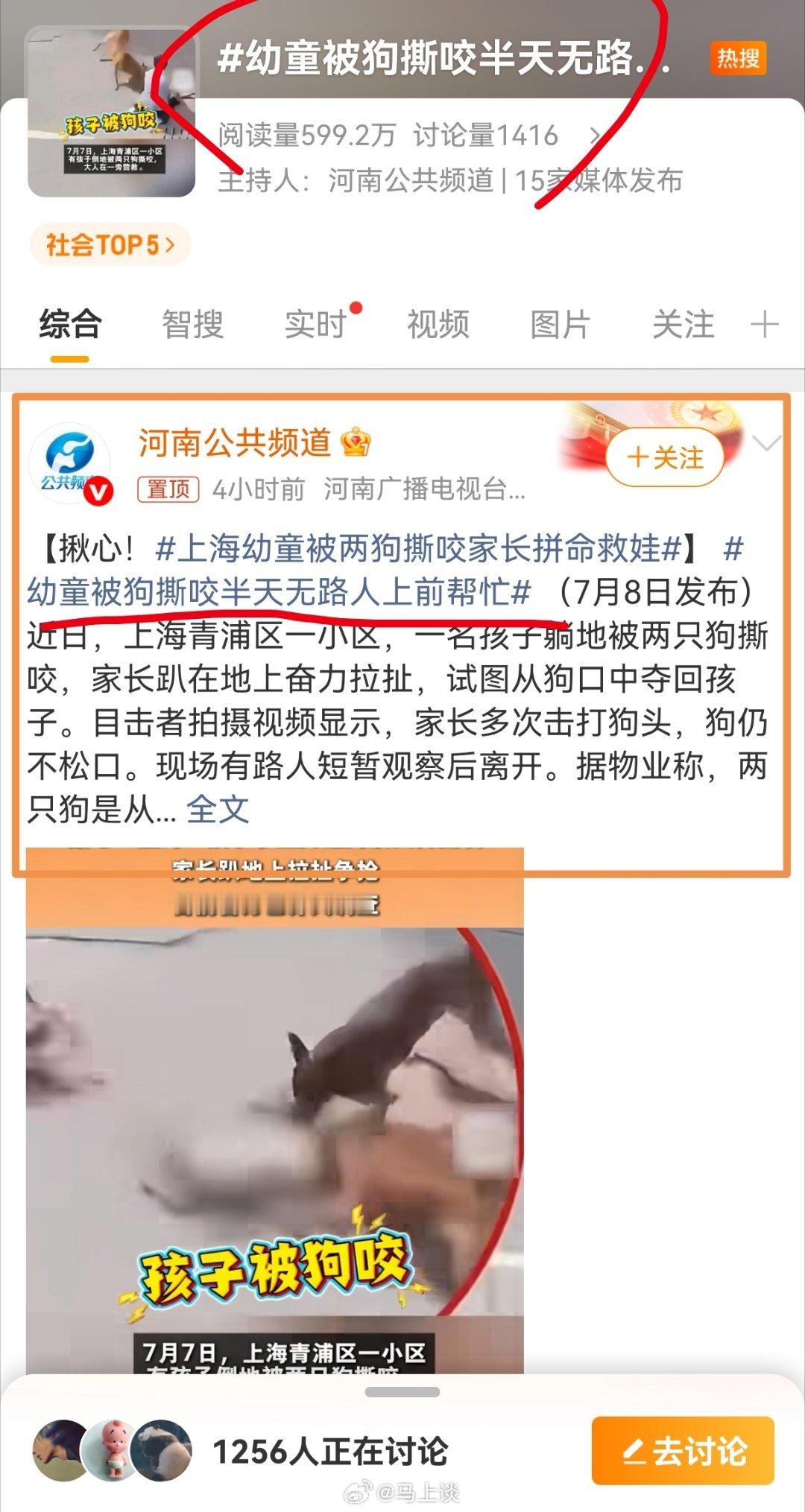 幼童被狗撕咬半天无路人上前帮忙 上海两只狗咬住一幼童拖行撕咬，我们该批判什么？批
