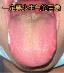 气温一回升，这种舌头就很常见了。
 
男科差劲，宗筋不起，时间短，脑子里想法还特