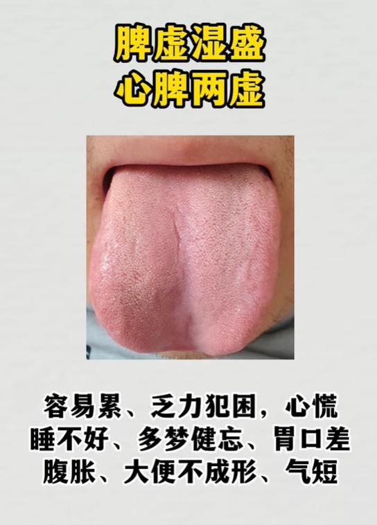 犯困失眠腰酸怕冷，3 种舌诊，看懂心脾两虚、脾肾亏虚、肝火夹寒湿