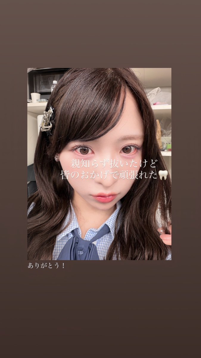 【图片】AKB48小栗有以